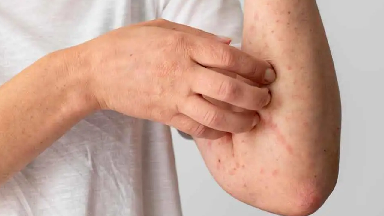 Yeni Kıyafetlerin Gizli Tehlikesi: Yıkanmadan Giyilen Giysilerde Uyuz Riski