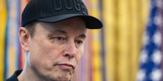 Tüm Dünyanın Merak Ettiği Gerçek Ortaya Çıktı: Elon Musk’ın Suratına Ne Oldu?